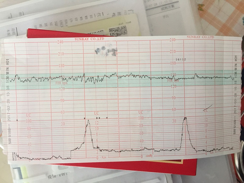 规律宫缩时间