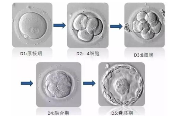 试管胚胎等级